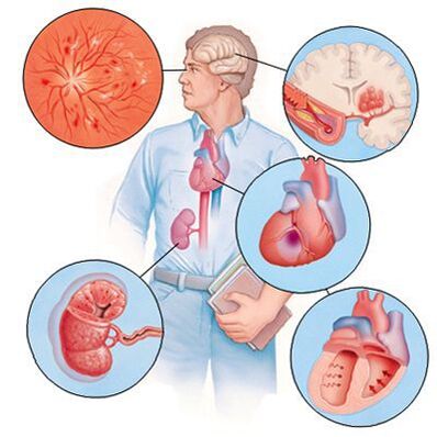 Cardiol zabraňuje rozvoji doprovodných onemocnění